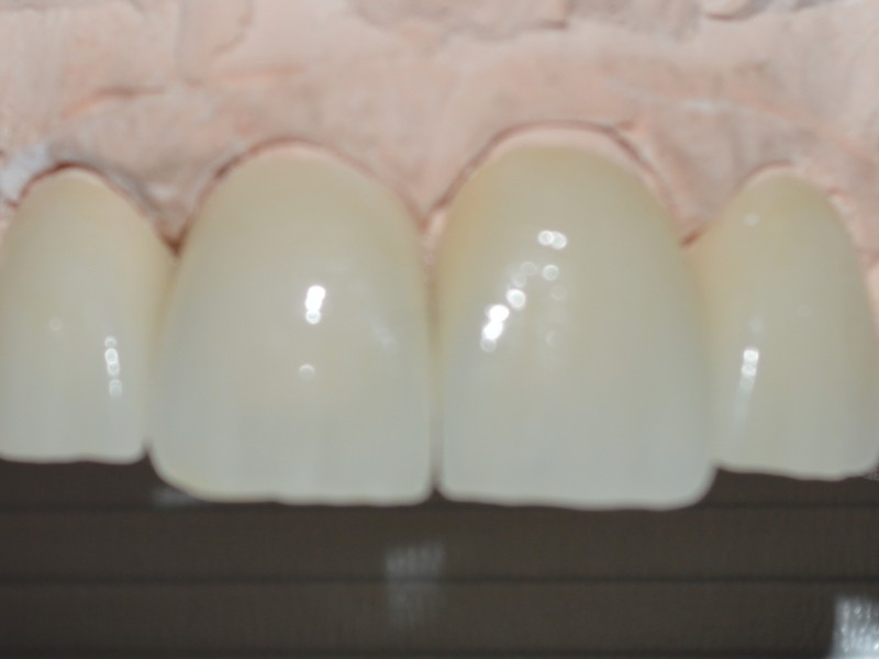 ct1